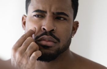 Man with facial hair inspecting his skin closely in a mirror.